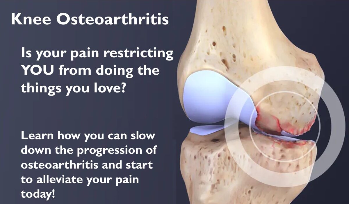 Knee OA